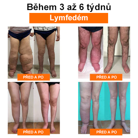 🐝🐝 AFGAFG™ Perličková koupel na odvodnění lymfatických uzlin a redukci váhy 🔥 Omezená doba: 70% SLEVA 🔥 (Minimální zásoba rychle vyprodána) 🔥