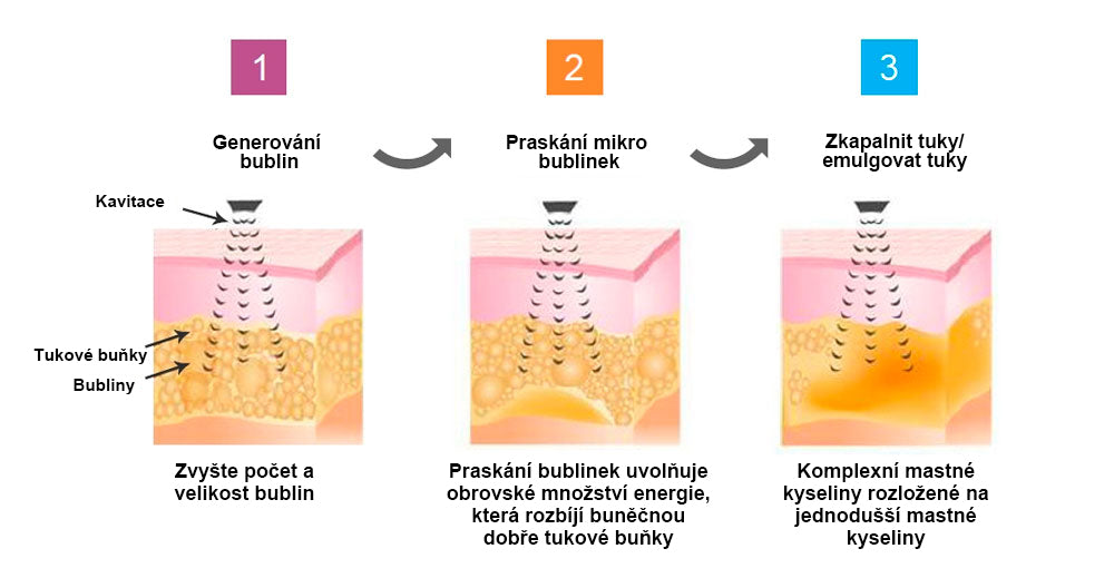 💪💪 Nejnovější SlimPulse™ náramek v roce 2024 pro destrukci tuků a ultrazvukovou detoxikaci - energetická rovnováha 🎁 (Limitovaná sleva + doporučení lékaře)