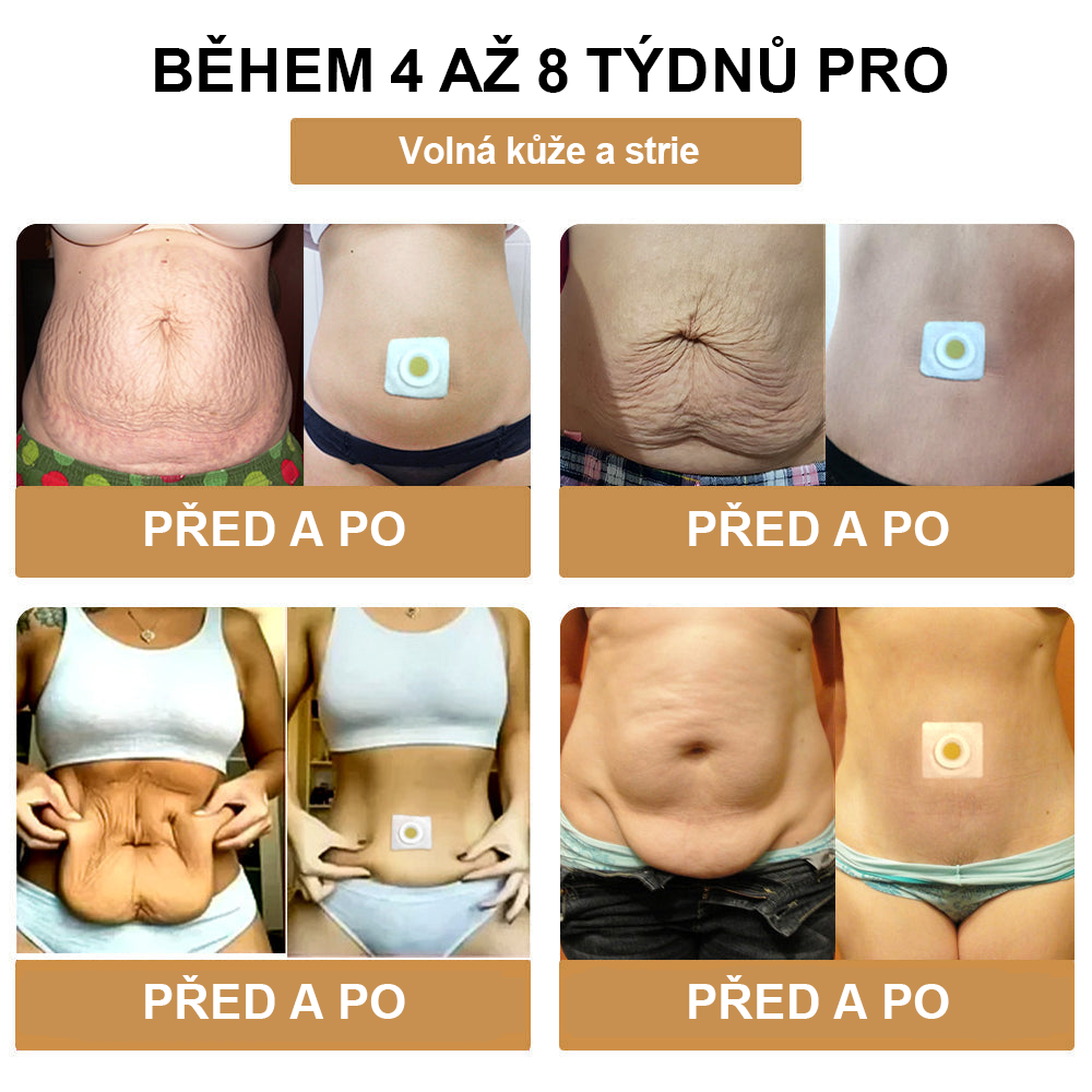 🎁🐝🐝Tady máte AFGAFG™ Beee Venom Lymfatic Drainage Slimming Patch 🔥Snižte čas 70% SLEVA🔥 (Vhodné pro použití individuály všech věků)🔥