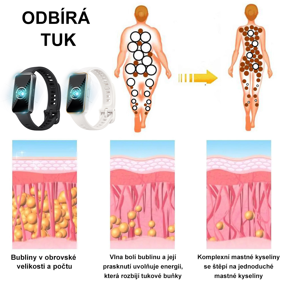 ✨🐳2024 Nejnovější ultrazvukové detoxikační hodinky „SonicMotion“ - energetická rovnováha🎁(časově omezená sleva + doporučení lékaře)