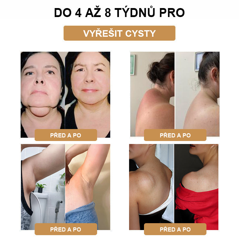 💪💪 Nejnovější SlimPulse™ náramek v roce 2024 pro destrukci tuků a ultrazvukovou detoxikaci - energetická rovnováha 🎁 (Limitovaná sleva + doporučení lékaře)