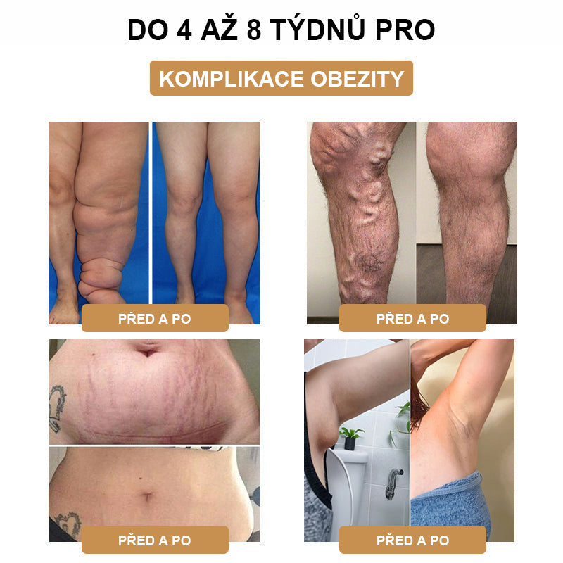 💪💪 Nejnovější SlimPulse™ náramek v roce 2024 pro destrukci tuků a ultrazvukovou detoxikaci - energetická rovnováha 🎁 (Limitovaná sleva + doporučení lékaře)